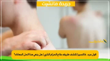 لأول مرة.. فاكسيرا تكشف طريقة علاج الحزام الناري هل ينهي هذا الحل المعاناة؟ 1